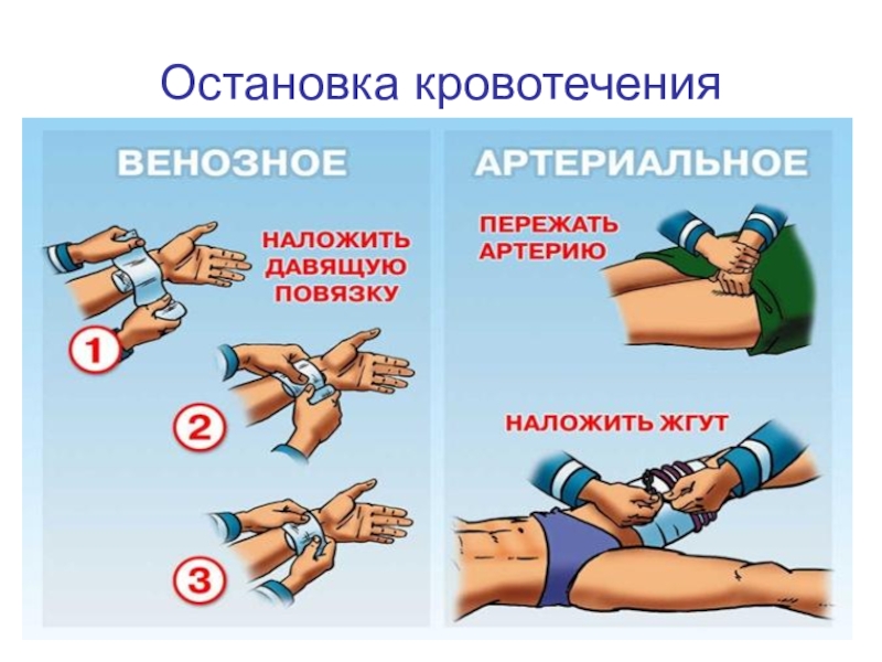 Презентация по обж первая медицинская помощь при кровотечениях