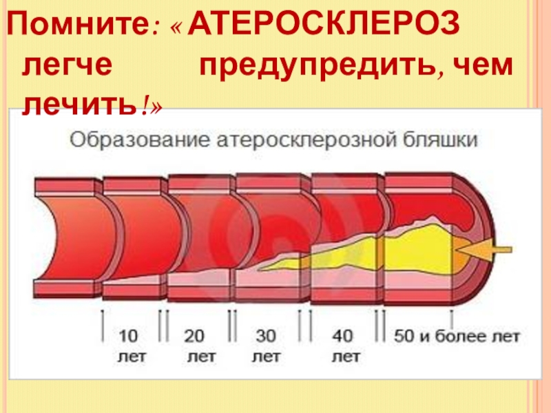 Атеросклероз причины