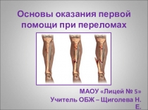 Презентация по ОБЖ на тему Основы оказания первой помощи при переломах