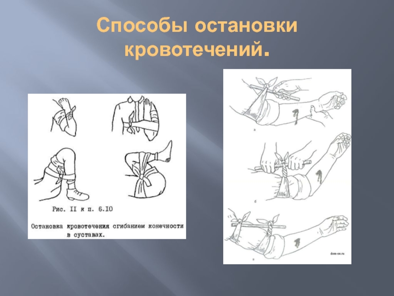 Оказание первой помощи при наружном кровотечении презентация по обж 7 класс