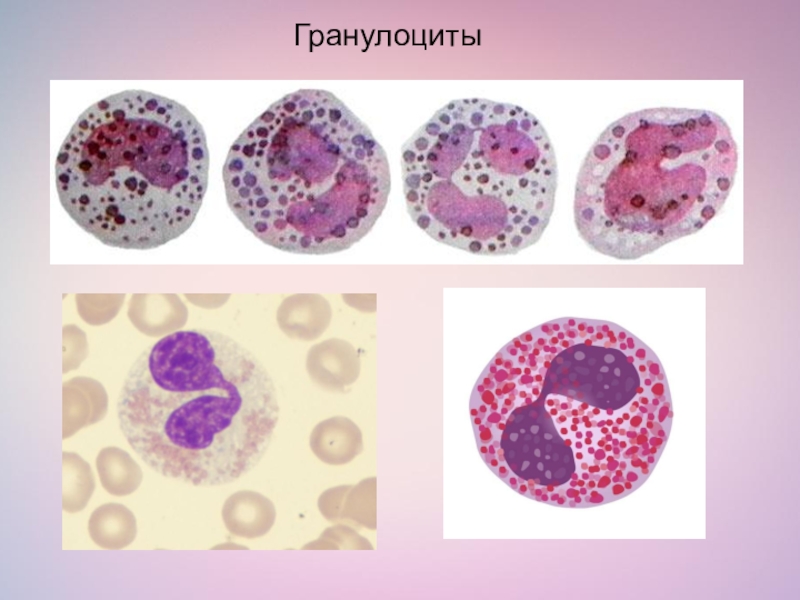 Гранулоциты это. Лейкоциты нейтрофильные гранулоциты. Нейтрофилы гранулоциты агранулоциты. Нейтрофильный лейкоцитоз гистология. Гранулоциты и агранулоциты.