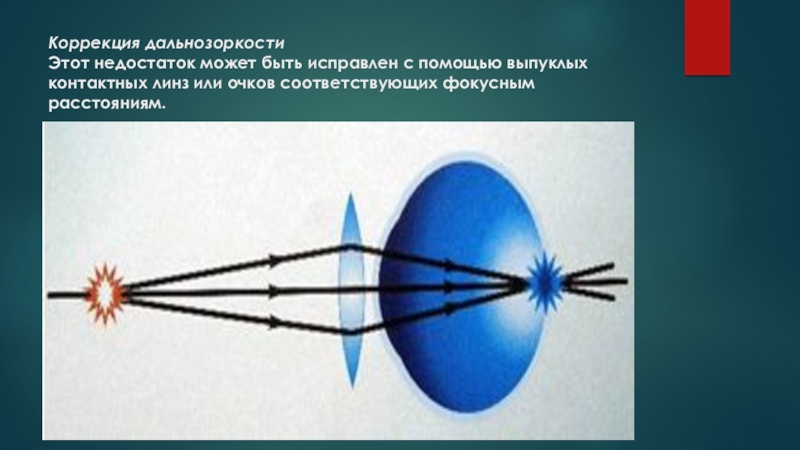 Презентация к уроку зрительный анализатор 8 класс