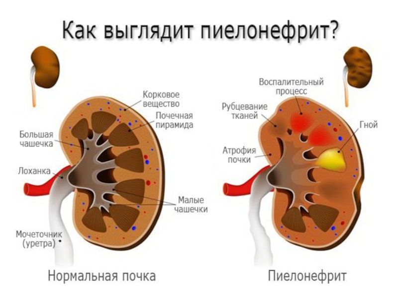 Презентация по биологии выделительная система 8 класс