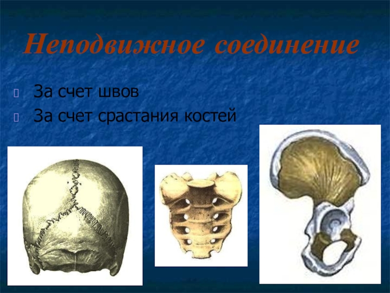 Кости первых текст. Шов это неподвижное соединение костей. Швы это соединение костей. Соединения костей презентация. Тип соединения костей с помощью швов.