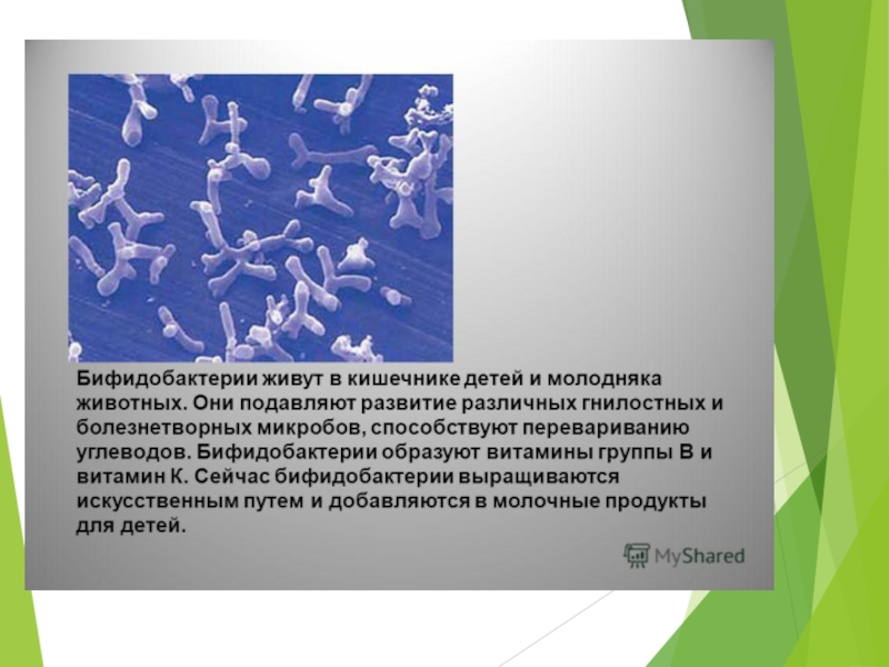 Бифидо бактерий. Бифидобактерии. Бифидобактерии строение. Строение бифидобактерий. Бифидобактерии описание.