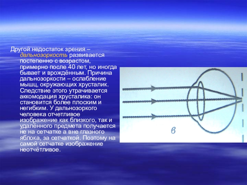 Презентация по физике дальнозоркость