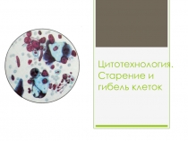 Презентация по биологии на тему Цитология. Старение и гибель клетки (10 класс)