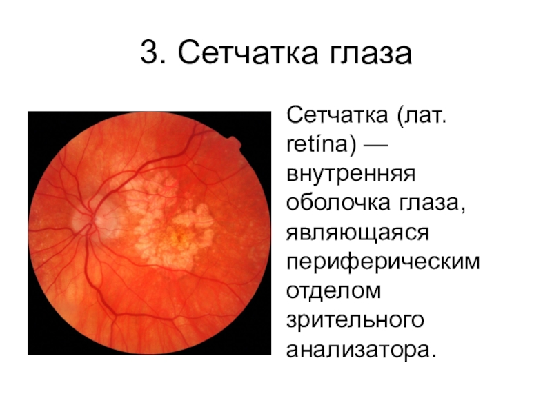 Функция сетчатки глаза человека. Сетчатка глаза. Внутренняя оболочка глаза сетчатка. Структура сетчатки. Сетчатая оболочка глаза.
