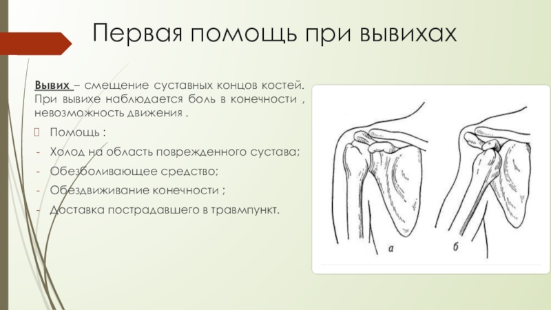 Дайте определение понятию вывих. При вывихе плечевого сустава.