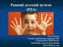 Выступление на заседании методического объединения учителей начальных классов Ранний детский аутизм