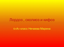 Презентация по физической культуре на тему Нарушения осанки