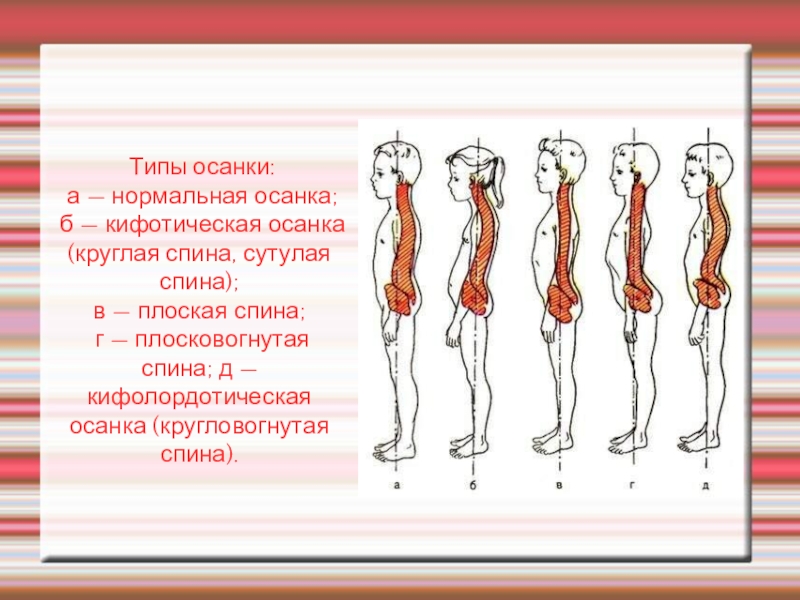 Рассмотрите рисунки 1 4 с изображением типов осанок человека как называют нарушение осанки 4