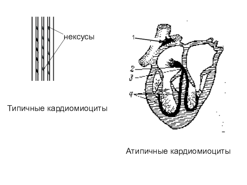 Атипичные кардиомиоциты рисунок