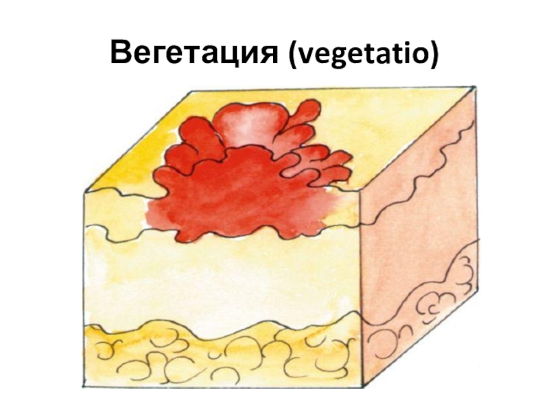 Усиление кожного рисунка