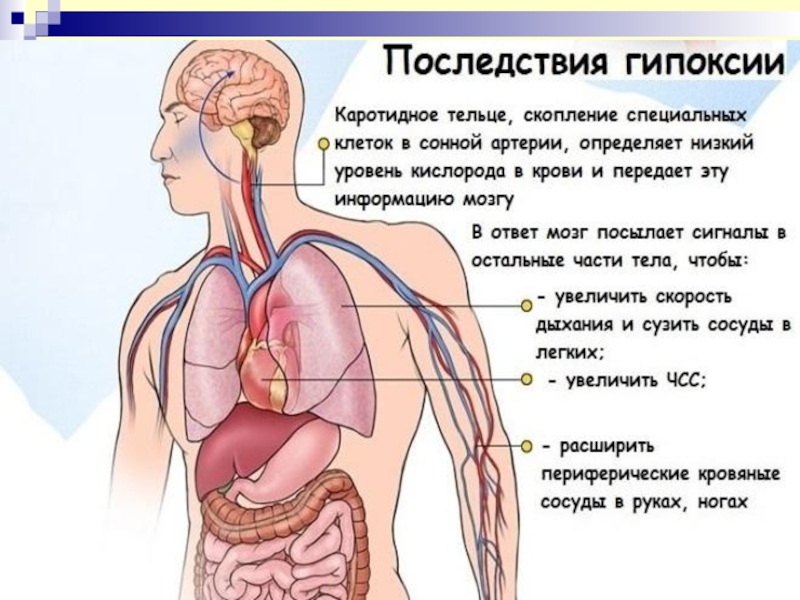 Гипоксия фото для презентации