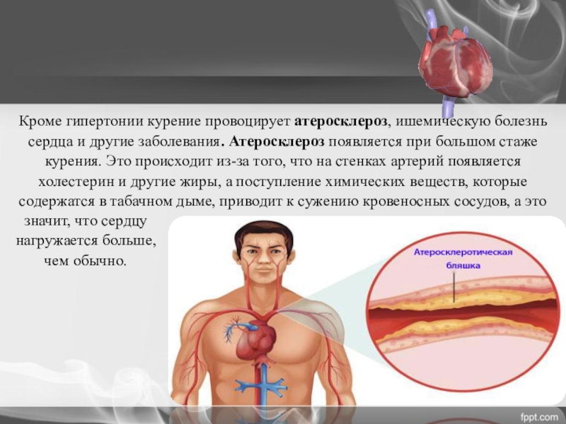 Болезни вызванные курением презентация