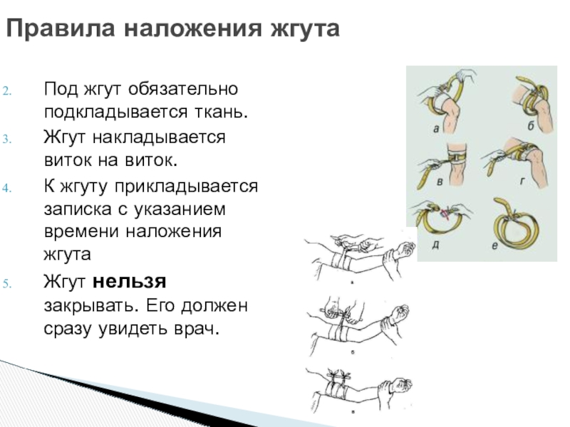 Правила наложения жгута презентация