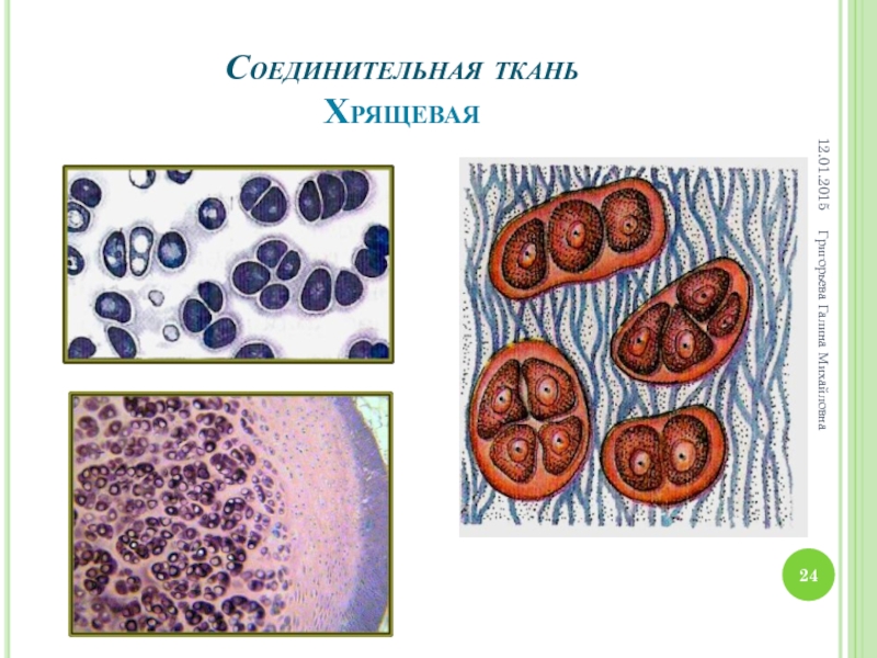 Соединительная ткань хрящ строение и функции. Подвиды соединительной ткани. Мезенхима соединительная ткань гистология. Хрящевая соединительная ткань. Соединительная ткань образует хрящи.