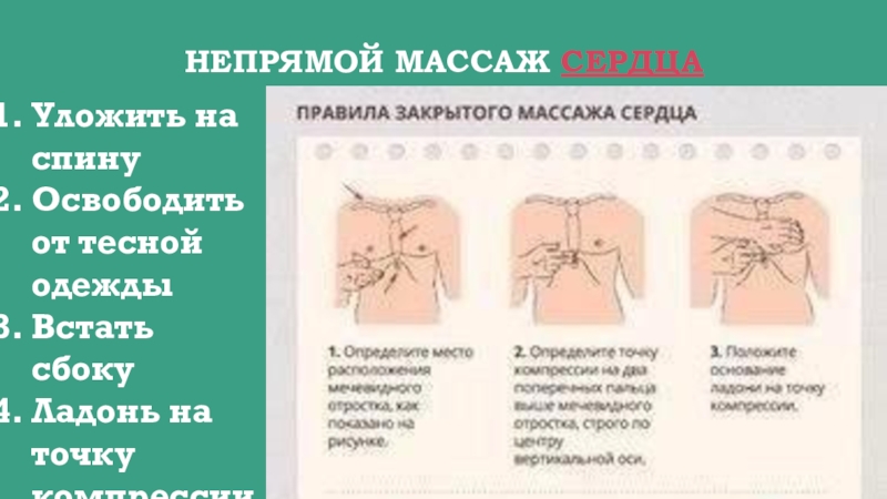 непрямой массаж сердца проводится. непрямой массаж сердца на спине. непрямой массаж сердца на спине. непрямой массаж сердца на спине. ритмичность непрямого массажа сердца.
