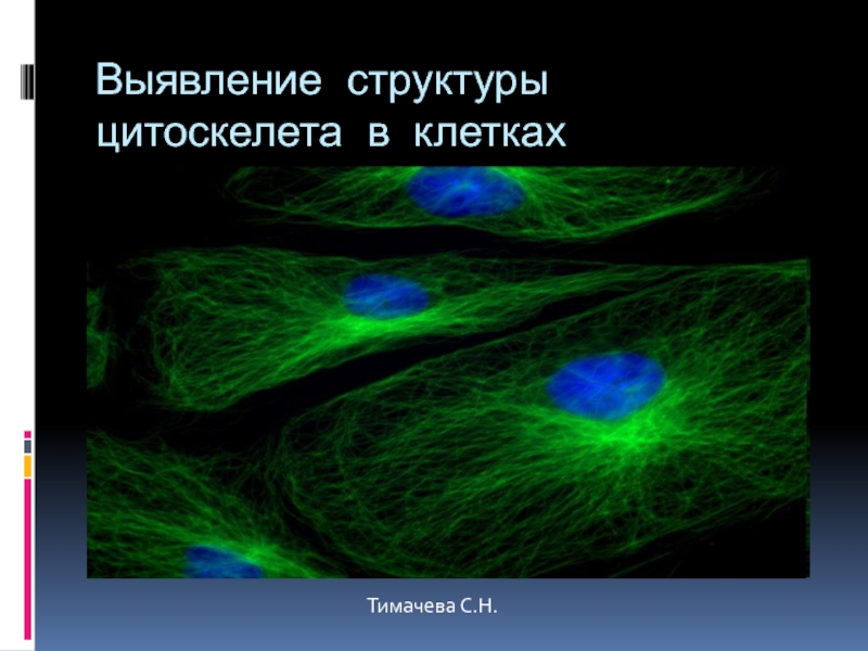 Выявление структуры цитоскелета в клеткахТимачева С.Н.