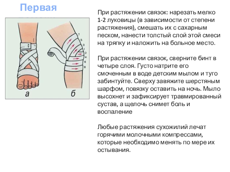 Первые признаки растяжения связок. Первая степень растяжения связок. Что делать при растяжении связок.