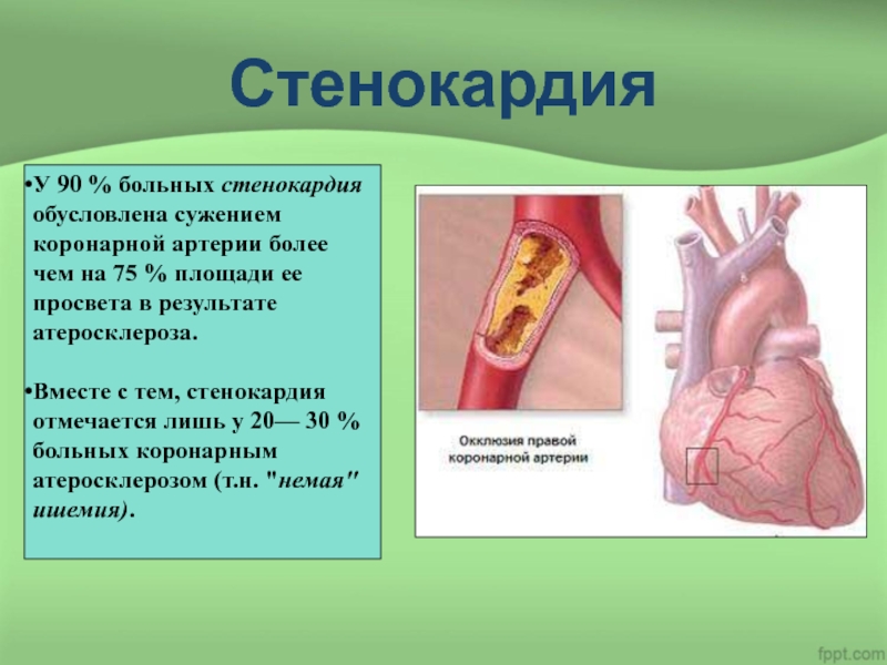 Стенокардия презентация по фармакологии