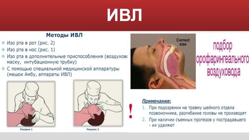 Способ рта. СЛР искусственная вентиляция легких. Искусственное дыхание легких. Сердечно-легочная реанимация ИВЛ.