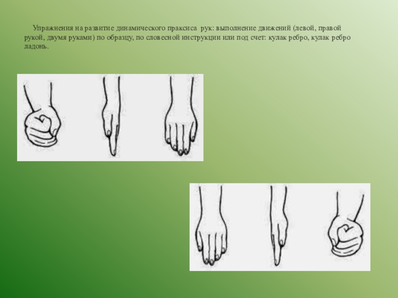 Праксис поз по зрительному образцу