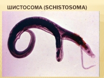 Презентация по ОП. 04 Медицинская паразитология на тему Шистосома