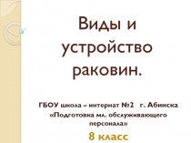 Презентация Виды, устройство раковин по предмету Подготовка младшего обслуживающего персонала 8 класс