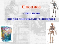 Презентация по биологии Сколиоз 8 класс
