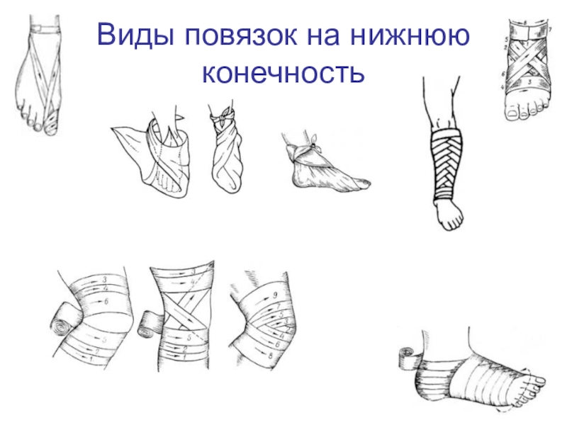 Презентация виды повязок обж