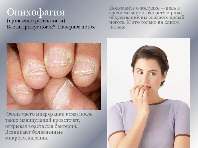 Онихофагия (привычка грызть ногти) Все ли грызут ногти? Наверное не все. Очень часто микроранки кожи после таких