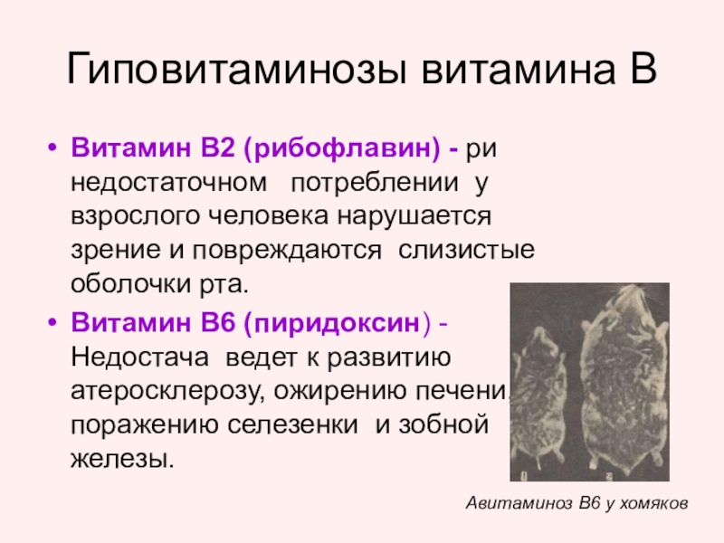 Гипо 2. Признаки гипервитаминоза витамина в2. Проявление гиповитаминоза витамина в2. Признаки гиповитаминоза в2. Витамин в2 симптомы гиповитаминоза.