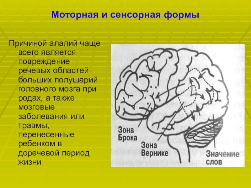 Сенсорная речь моторная речь