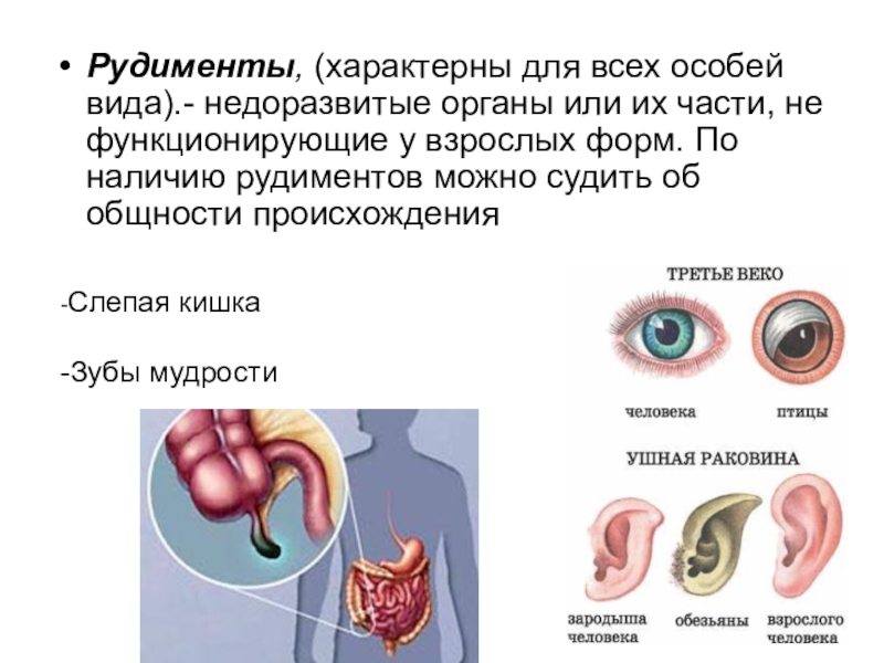 3 примеры рудиментов. Рудименты в организме человека. Рудиментарные органы человека. Рудименты и рудиментарные органы. Виды рудиментарных органов.