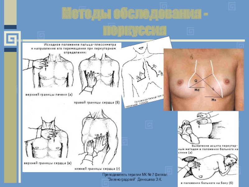 Осмотр пропедевтика. Пальпация, перкуссия, аускультация сердечно-сосудистой системы.. Пропедевтика аускультация перкуссия пальпация. Методы обследования перкуссия. Пальпация перкуссия аускультация сердца.