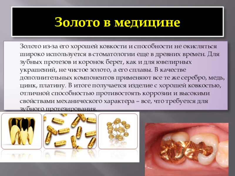 Золото название элемента. Золото в медицине. Золото в стоматологии. Применение золота. Золото для презентации.