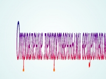 Презентация по ПМ 03 Неотложная медицинская помощь на догоспитальном этапе на тему Отравления лекарственными средствами