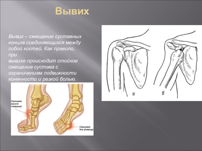 Вывих картинки для детей