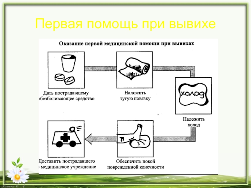 1 помощь при вывихе. Алгоритм оказания 1 помощи при вывихе. Правила оказания первой медицинской помощи при вывихах.