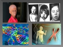 Презентация проекта по биологии Наследственные болезни