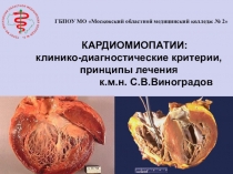 Кардиомиопатии: клинико-диагностические критерии, принципы лечения.