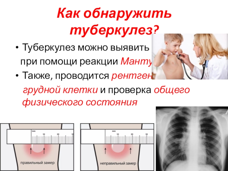 Туберкулез форум