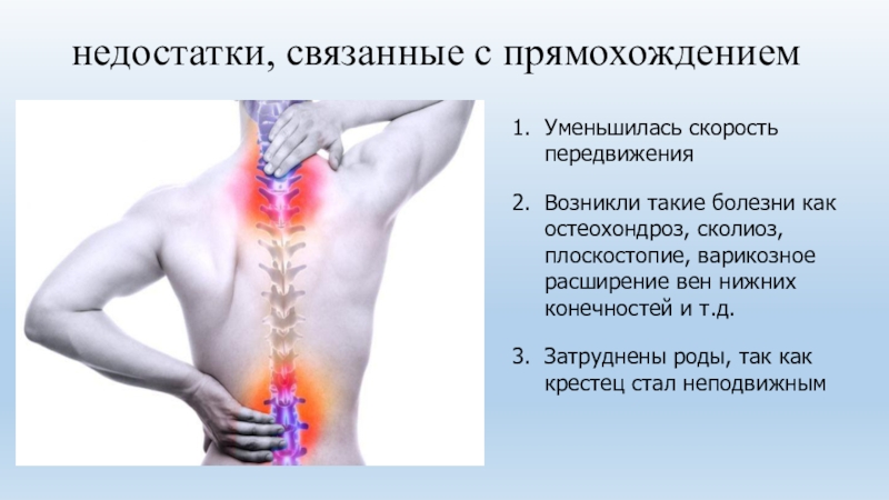 Особенности позвоночника человека связанные с прямохождением. Заболевания человека связанные с прямохождением. Недостатки связанные с прямохождением. Какие болезни человека связаны с прямохождением. Недостатки прямохождения у человека.