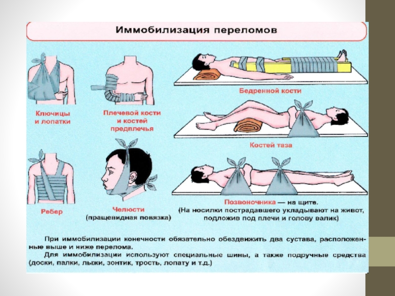 Презентация первая помощь при травмах опорно двигательной системы