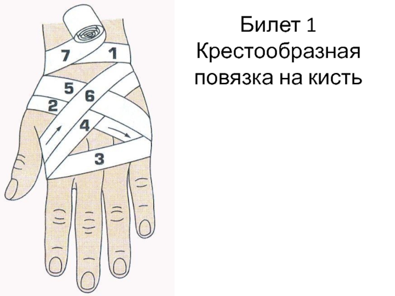 Крестообразная повязка. Восьмиобразная повязка на кисть. Крестообразная повязка на лучезапястный сустав алгоритм. Крестообразная (восьмиобразная) повязка на кисть. Наложение повязки на кисть (крестообразная повязка).