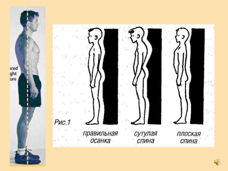 Плоская спина рисунок