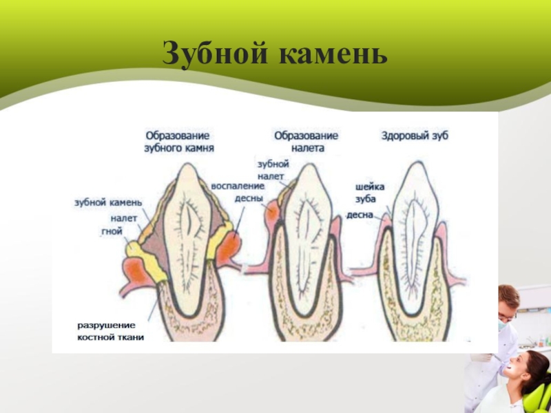 Ли зубной. Прочность зуба. Прочность зубной эмали.