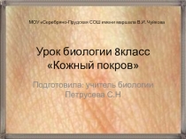 Презентация к уроку биологии Кожный покров(8класс)